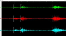 Waveforms from the CALIPSO Station